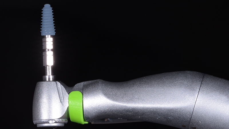 Fixture Megagen Anyridge prima dell'inserimento