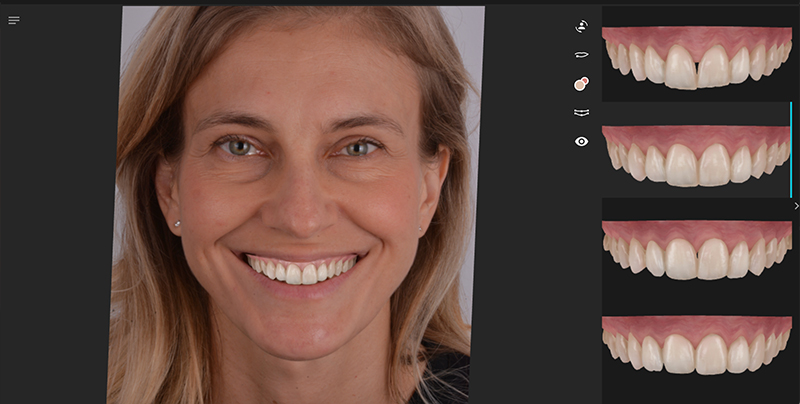 sviluppo diverse forme dentali con AI
