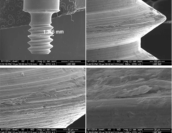 Immagine inerente lo studio "The morphology of collected dental implant prosthesis screws surface after six months to twenty years in chewing"
