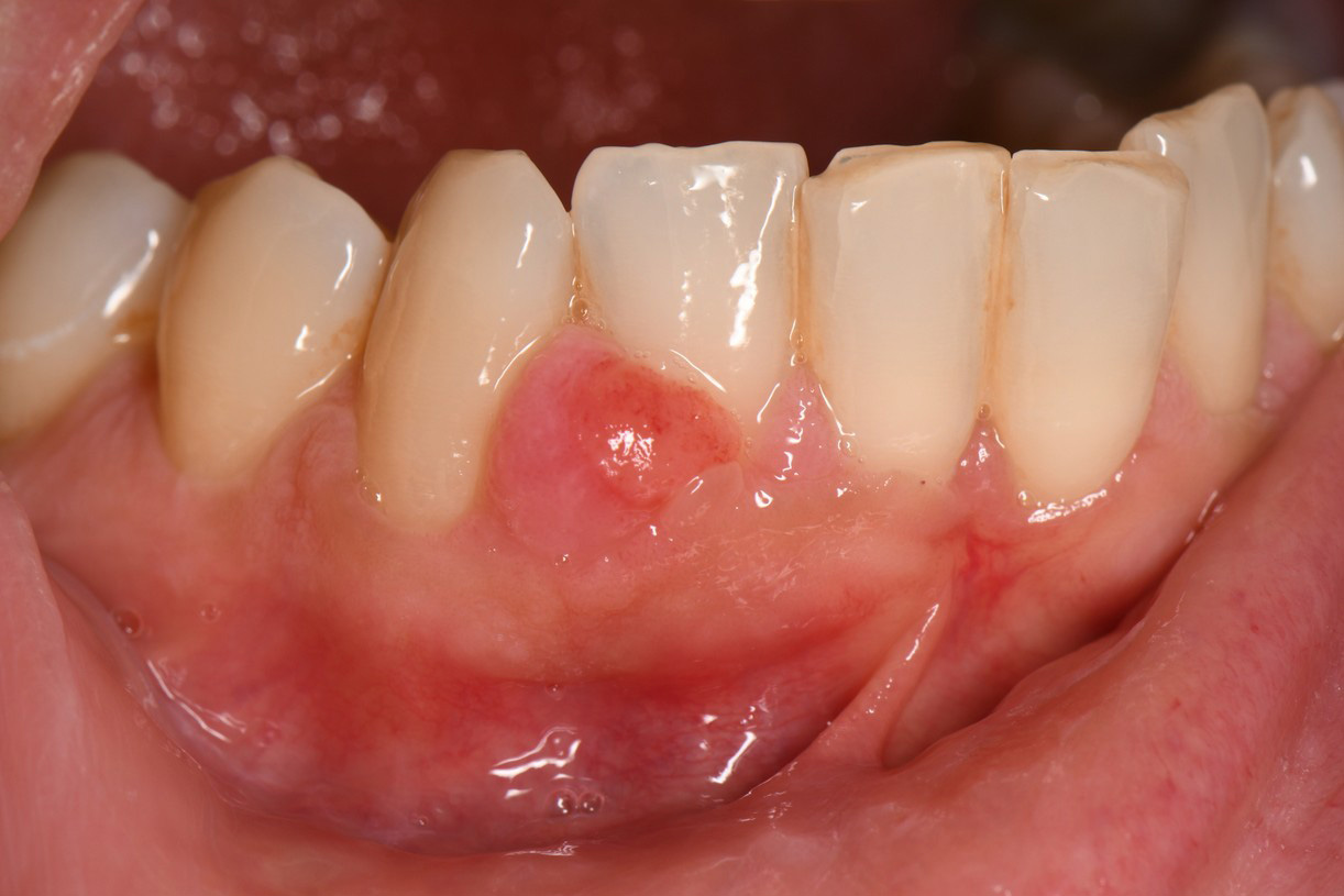 baseline (t0) case report 3