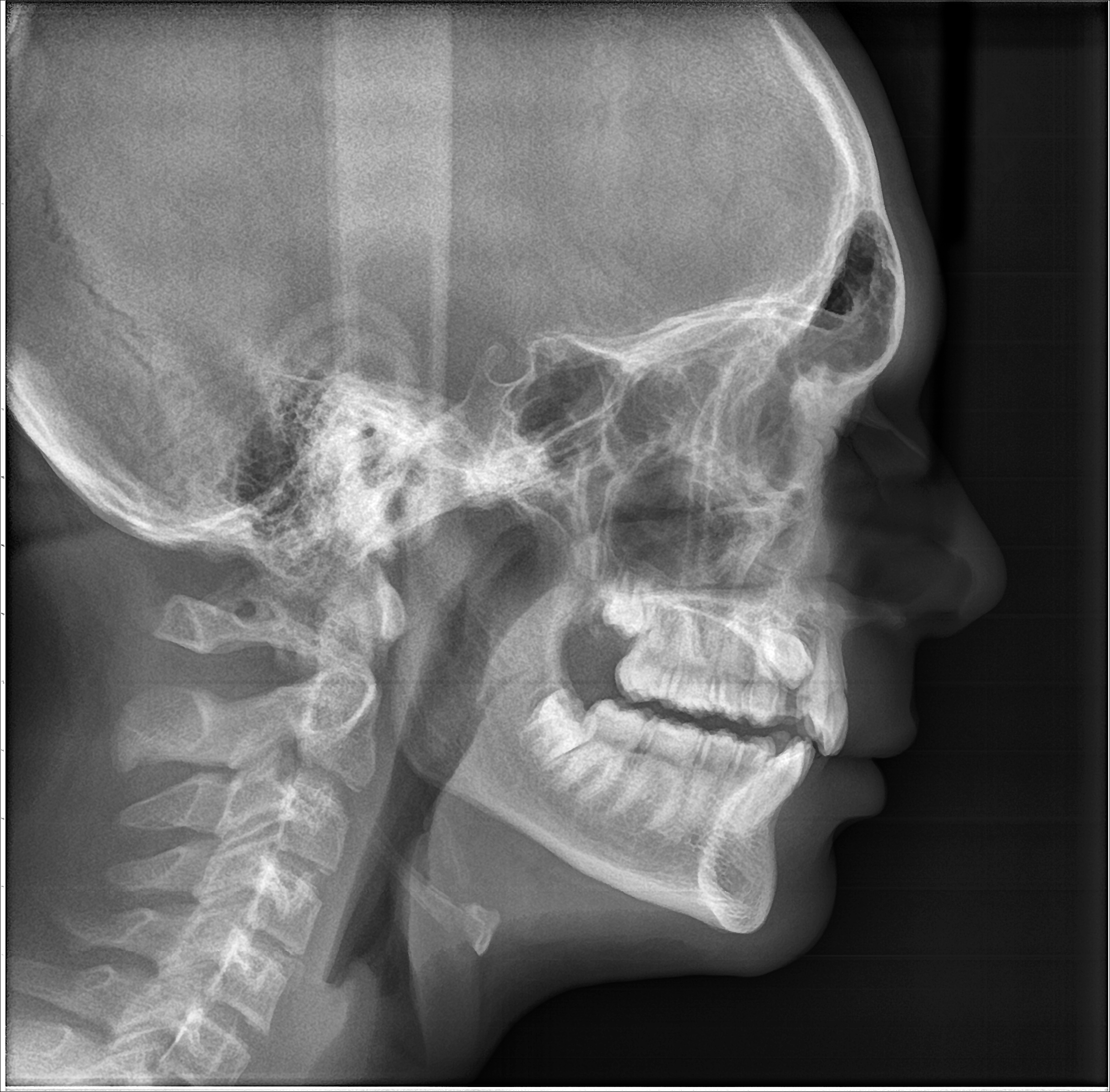 Analisi radiografica paziente