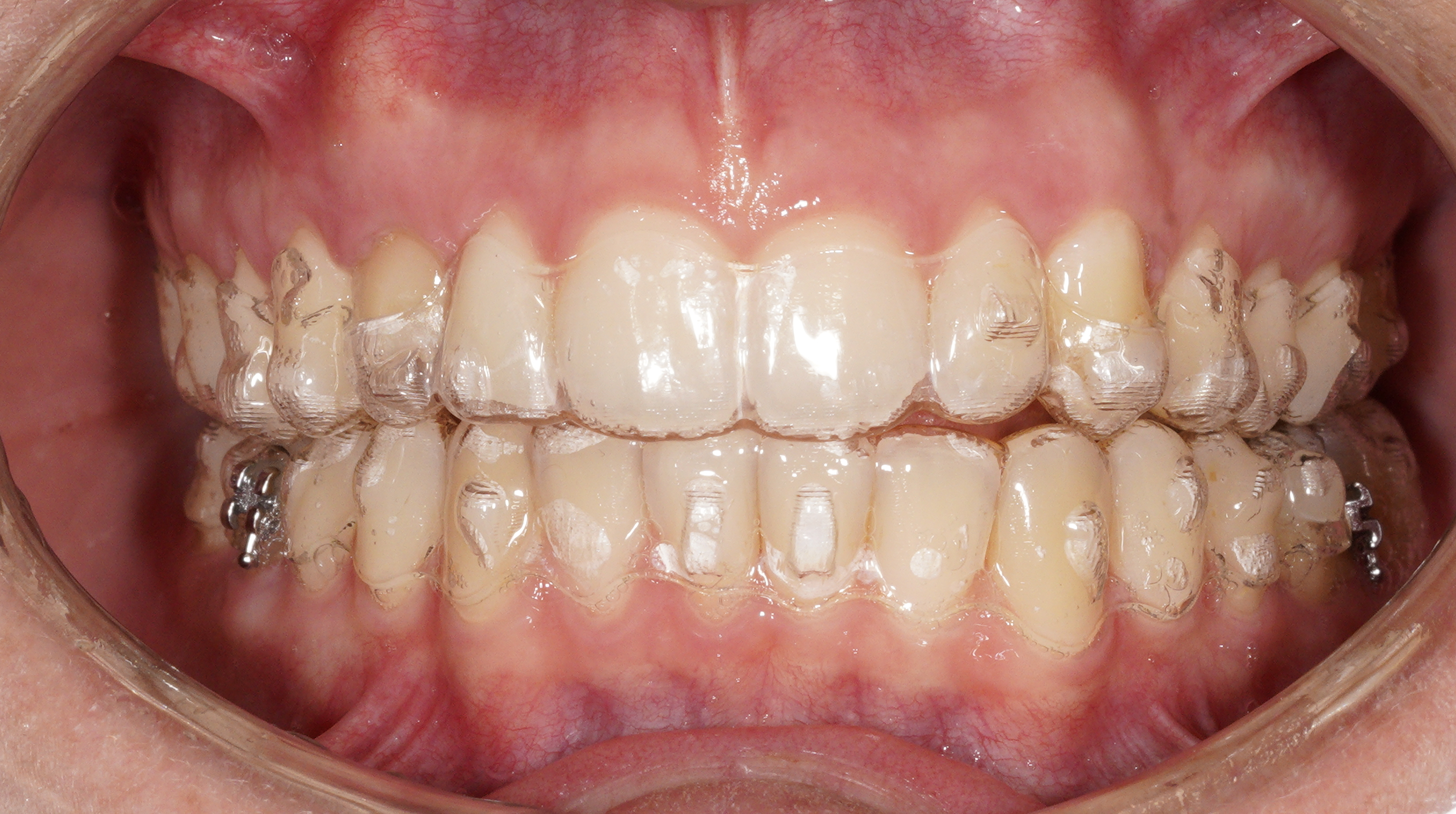 Risultato settembre 2024 5 