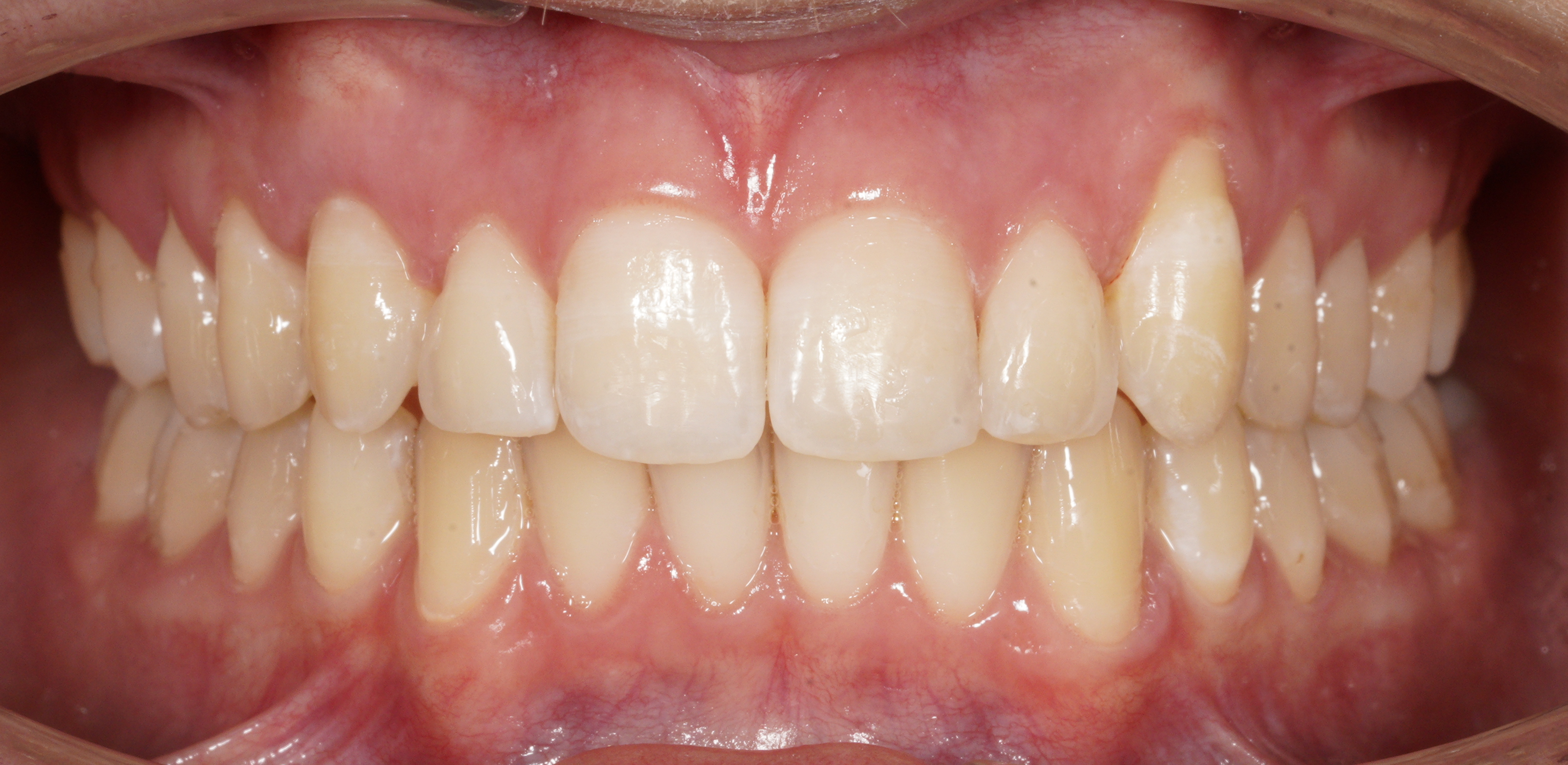 Risultato finale agosto 2025