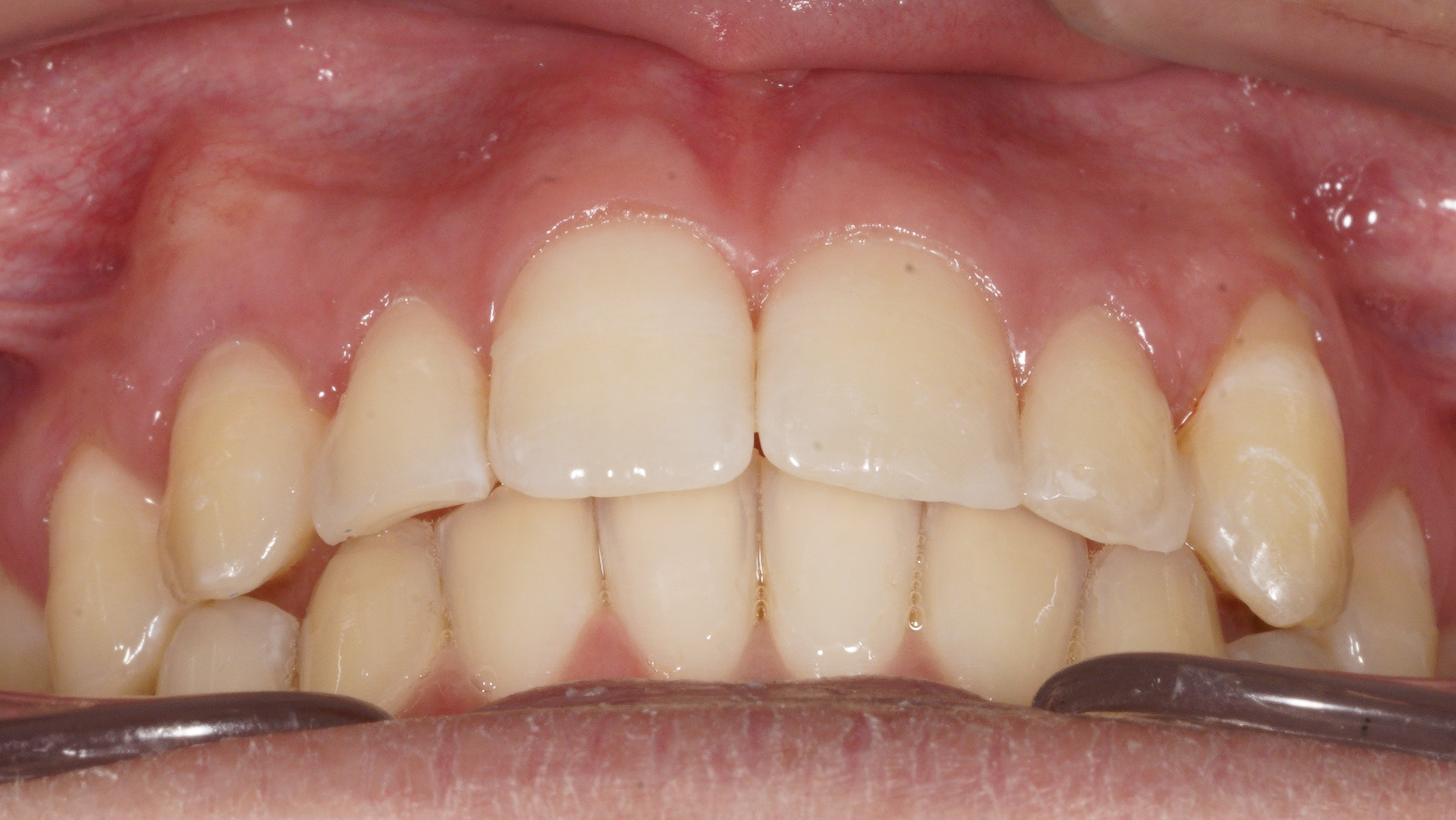 Risultato agosto 2025 2