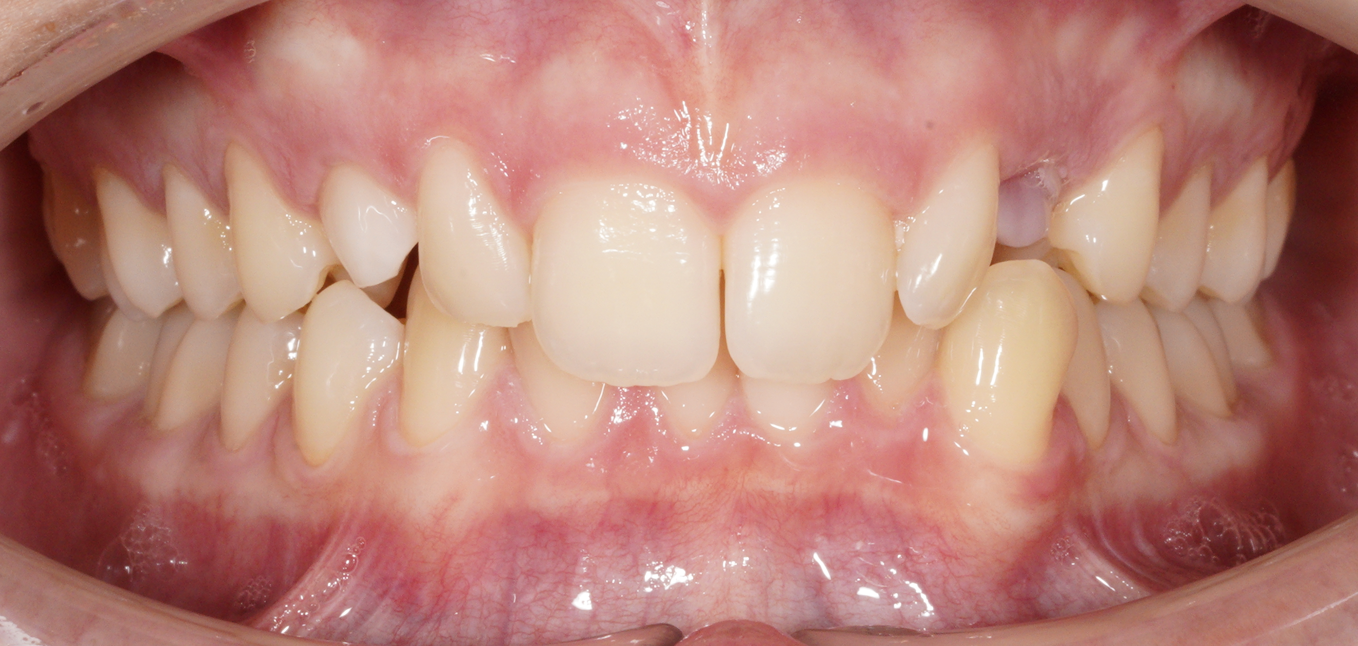 Analisi intra-orale paziente