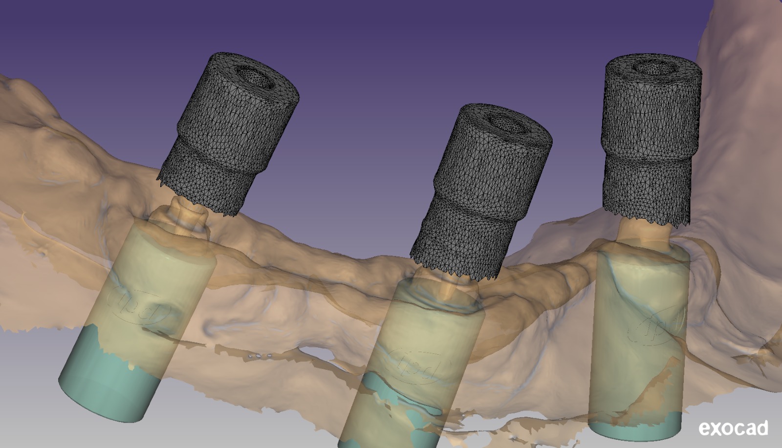 Fig. 3 - l'errore cresce con il numero di allineamenti e la distanza tra ipunti 