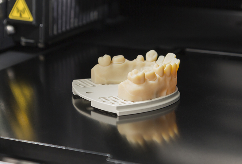 stampa in 3D di protesi dentale
