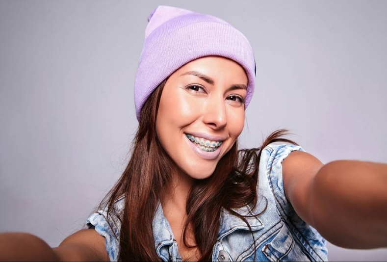 ragazza con apparecchio ortodontico in metallo