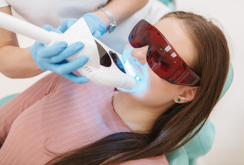 ragazza effettua uno sbiancamento dei denti