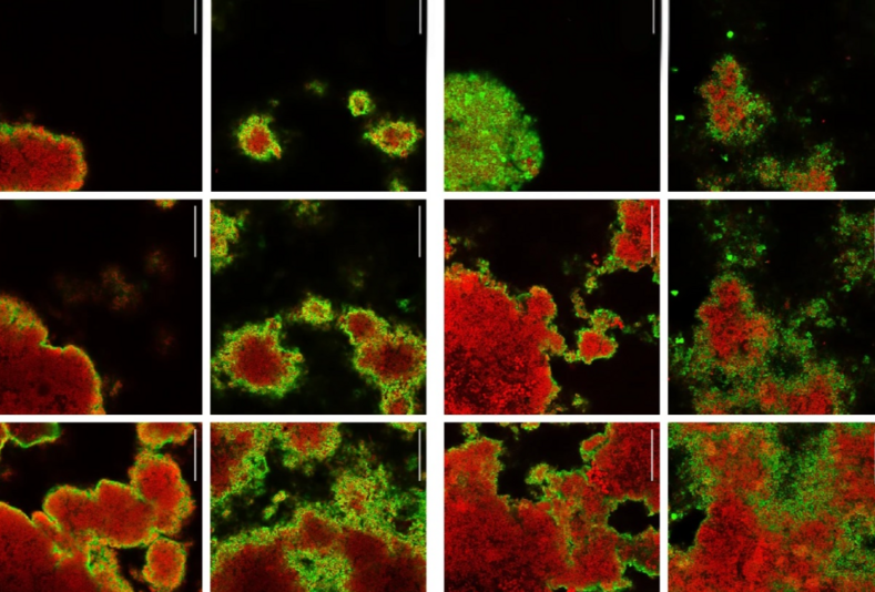 Arginina e carie: come cambia il biofilm dentale nei pazienti ad alto rischio