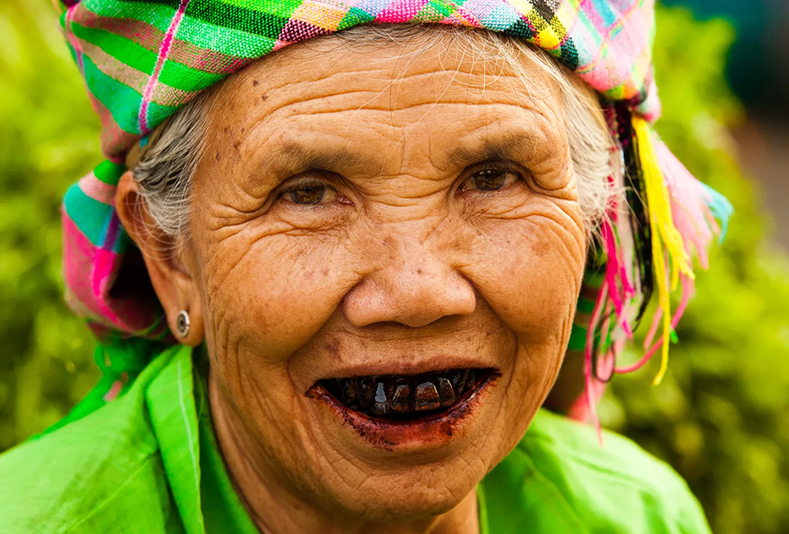 Donna anziana con pasta nera sui denti