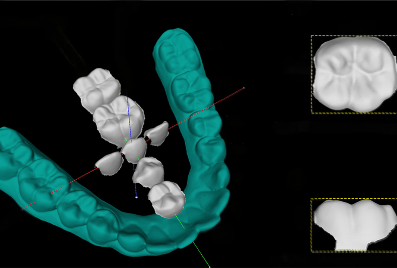 I geni che modellano i denti: nuove prospettive sulla morfologia dentale