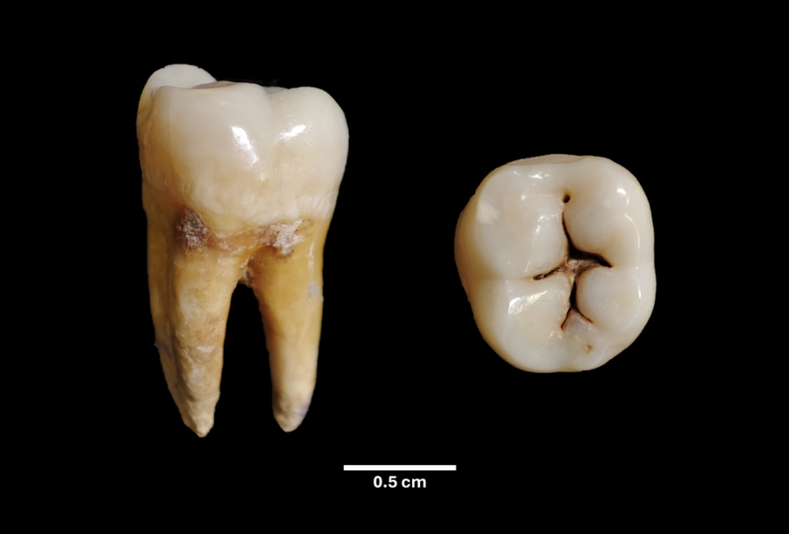 Infanzia etrusca nei denti di Pontecagnano