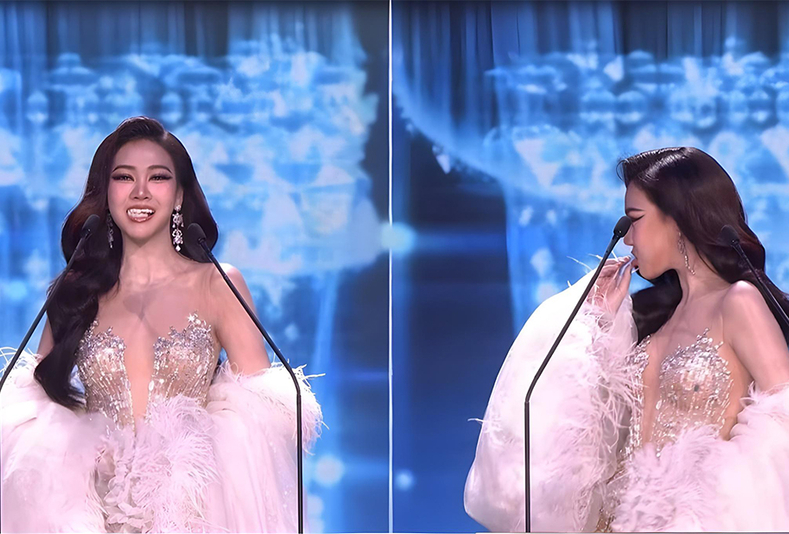 concorrente Miss Grand Thailandia perde faccette dentali dell'arcata superiore