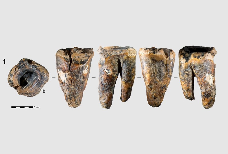 Denti Neanderthal