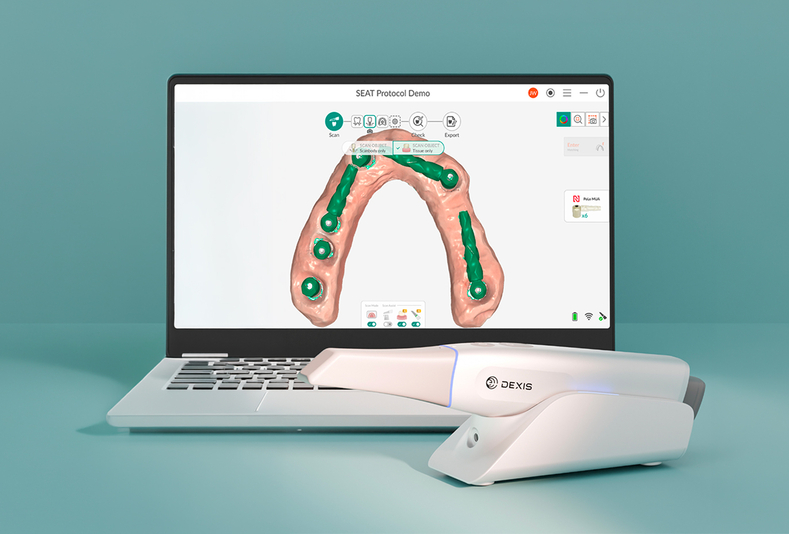 Software DEXIS in pc e scanner intraorale