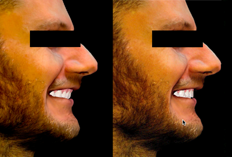 3D Face Scan