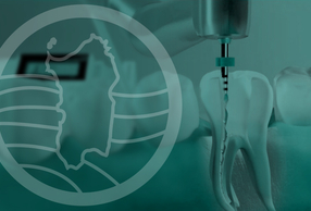 Endodonzia e Sardegna stilizzata