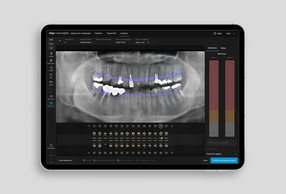 Align X-ray Insights