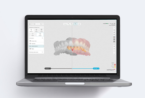 TRIOS DX Plus screen