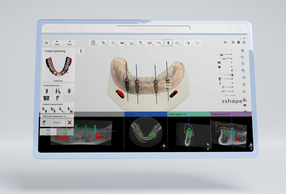Implant Studio 2026.1
