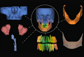 CBCT 