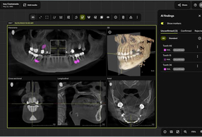 Software Smart View-Detect