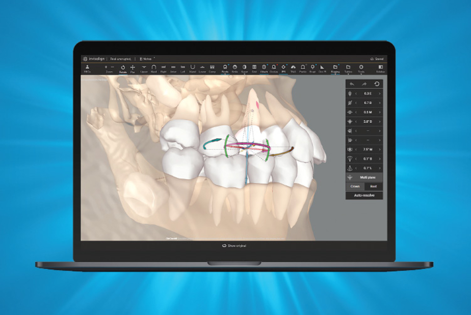 CBCT Invisalign