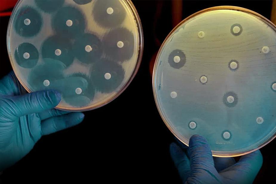 test microbico con colonie batteriche