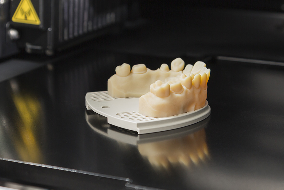 stampa in 3D di protesi dentale