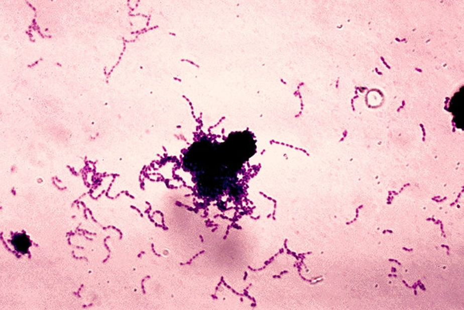 Streptococcus mutans