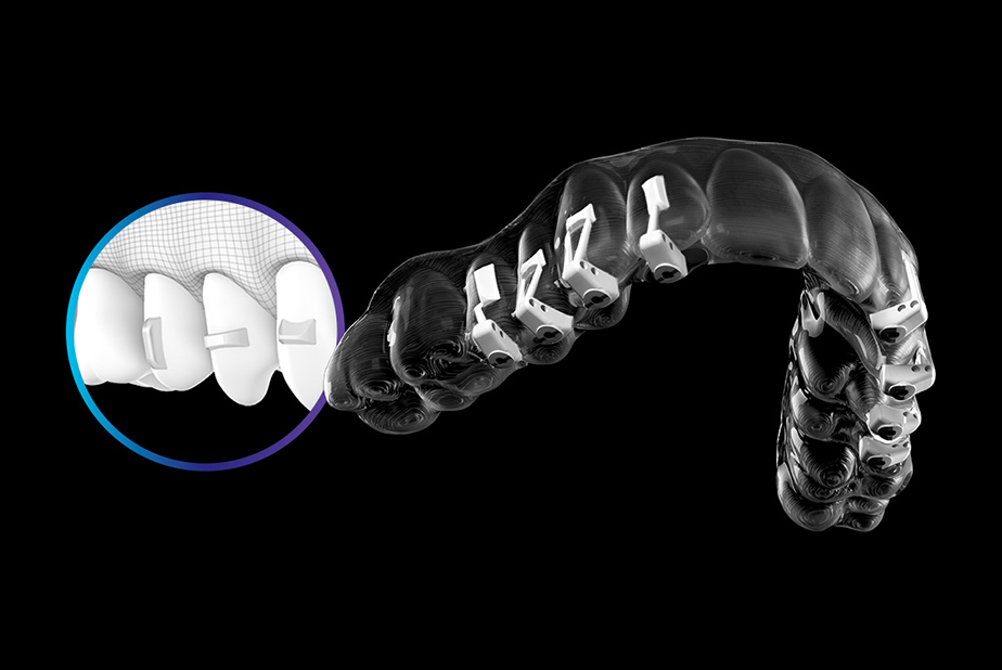 3M™ Clarity™ Precision Grip