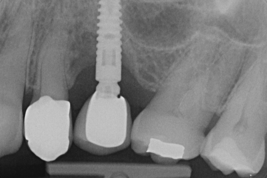 valutazione radiografica