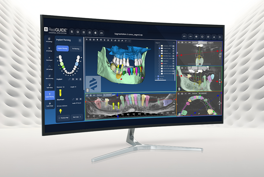 RealGUIDE Software Suite: il potere del Cloud e dell’AI a tua disposizione ovunque Computer con software 3Diemme aperto