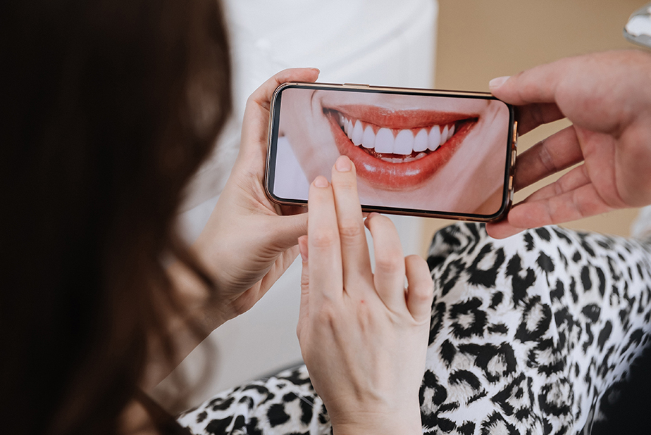 Estetica dentale tra marketing e overtreatment foto di sorriso su smartphone