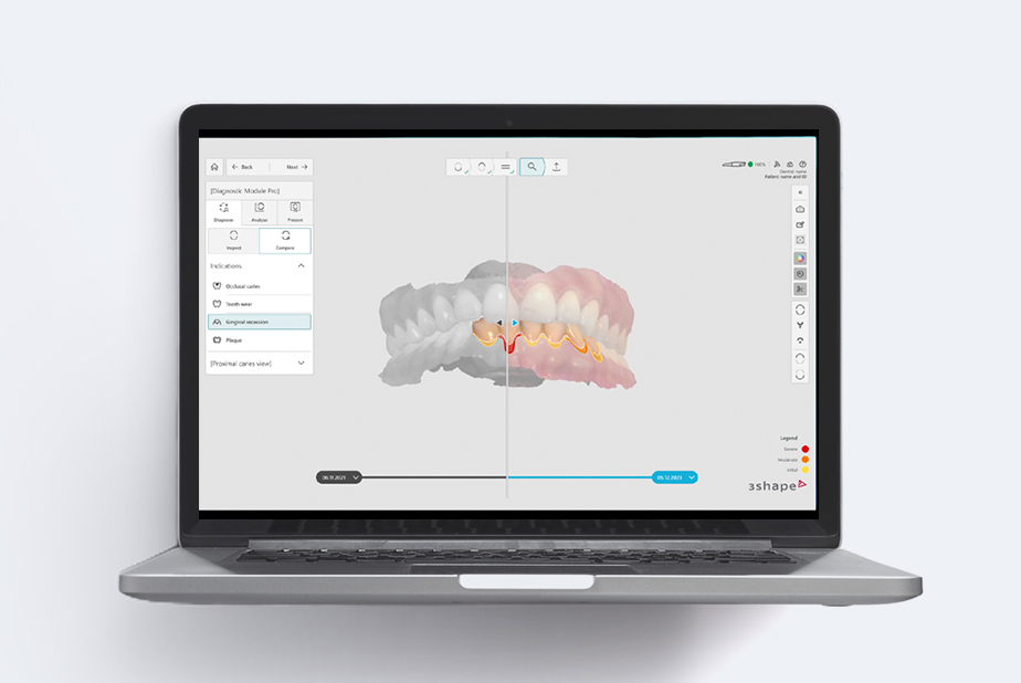 TRIOS DX Plus screen
