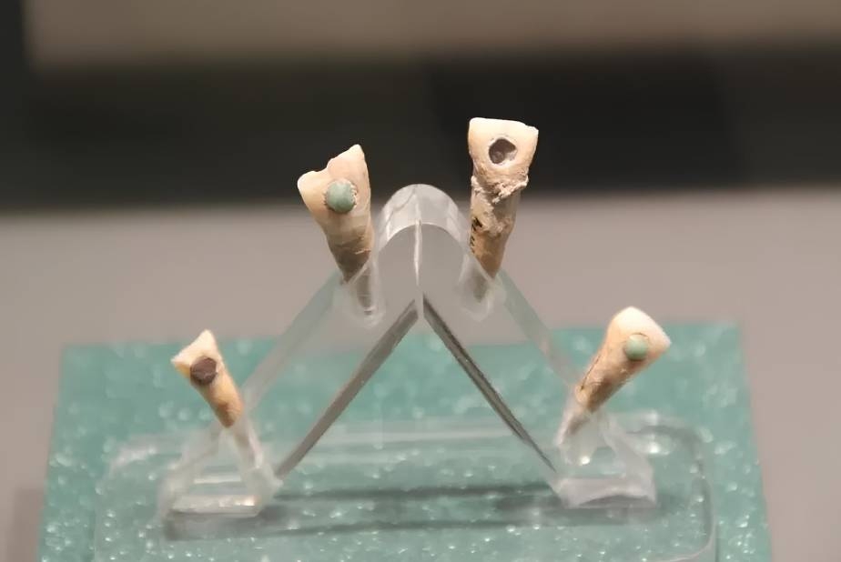 Intarsi di giada nei denti di bambini Maya