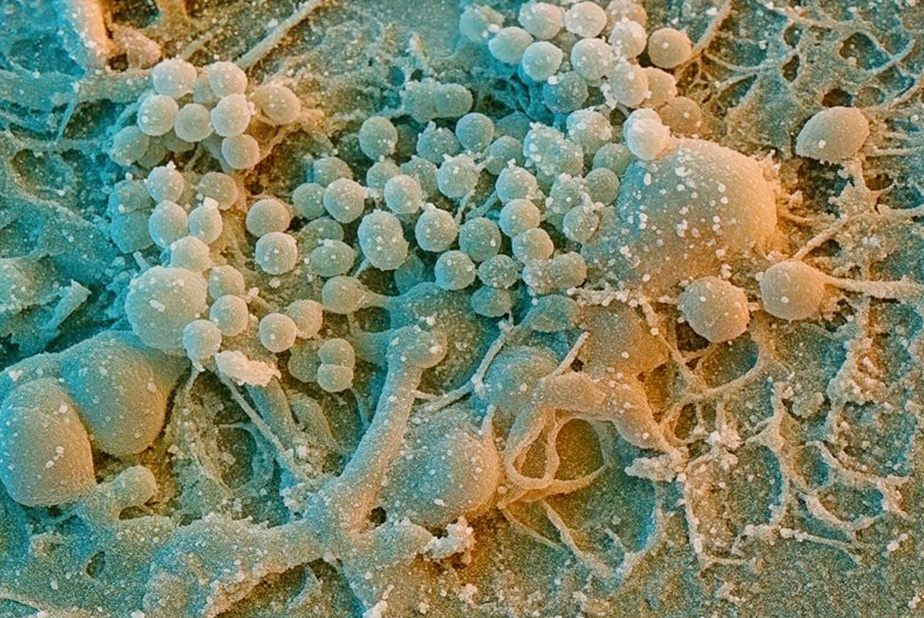 Enzimi per modulare la placca: nuove prospettive contro la parodontite Batteri della placca