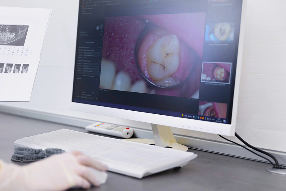 Digital photography e AI per la diagnosi precoce della carie Digital photography e AI