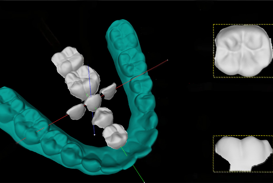 I geni che modellano i denti: nuove prospettive sulla morfologia dentale I geni che modellano i denti: nuove prospettive sulla morfologia dentale