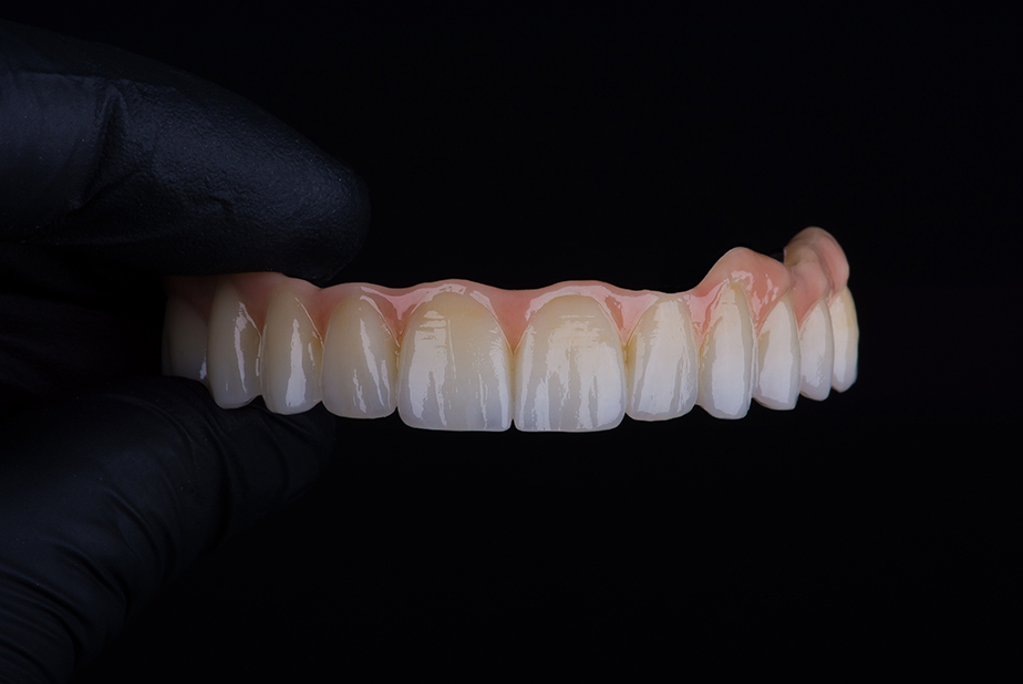 Denti in primo piano 