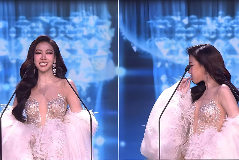 concorrente Miss Grand Thailandia perde faccette dentali dell'arcata superiore