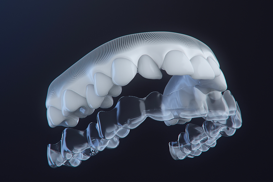 Allineatore trasparente Invisalign