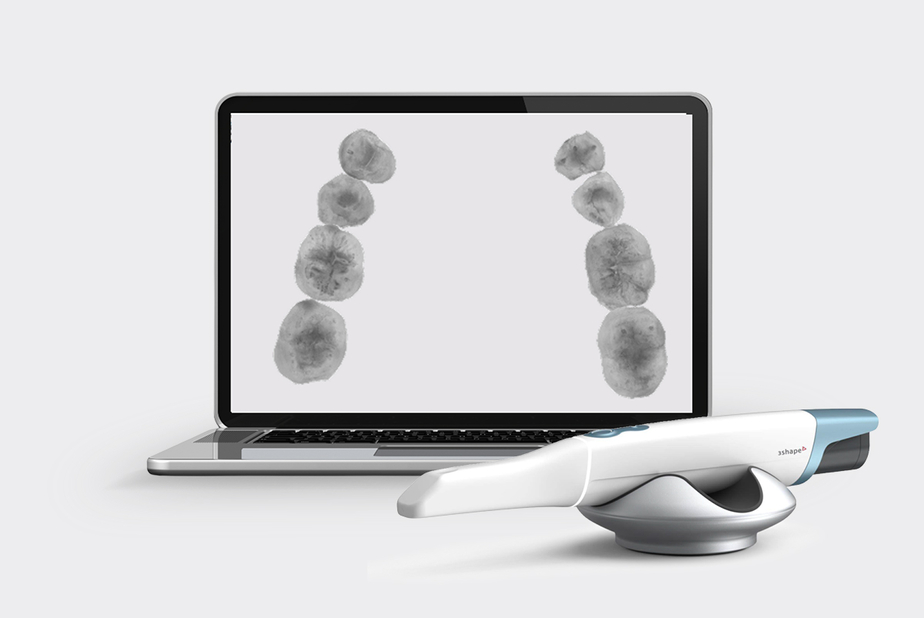 Carie interprossimali: la diagnosi diventa più chiara ed immediata con TRIOS 6 PC con software DX+ e Trios 6