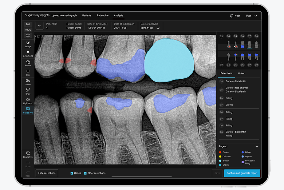 Aumenta il tuo potenziale diagnostico con Align X-ray Insights Align X-ray Insights