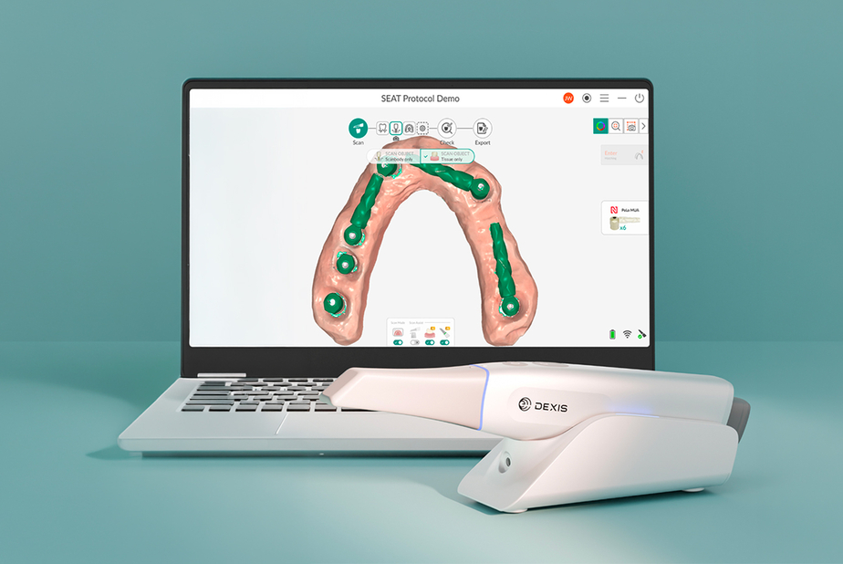Software DEXIS in pc e scanner intraorale